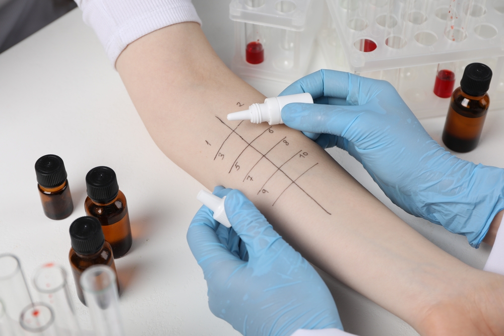 Doctor,Doing,Skin,Allergy,Test,At,Light,Table,,Closeup Doctor,Doing,Skin,Allergy,Test,At,Light,Table,,Closeup