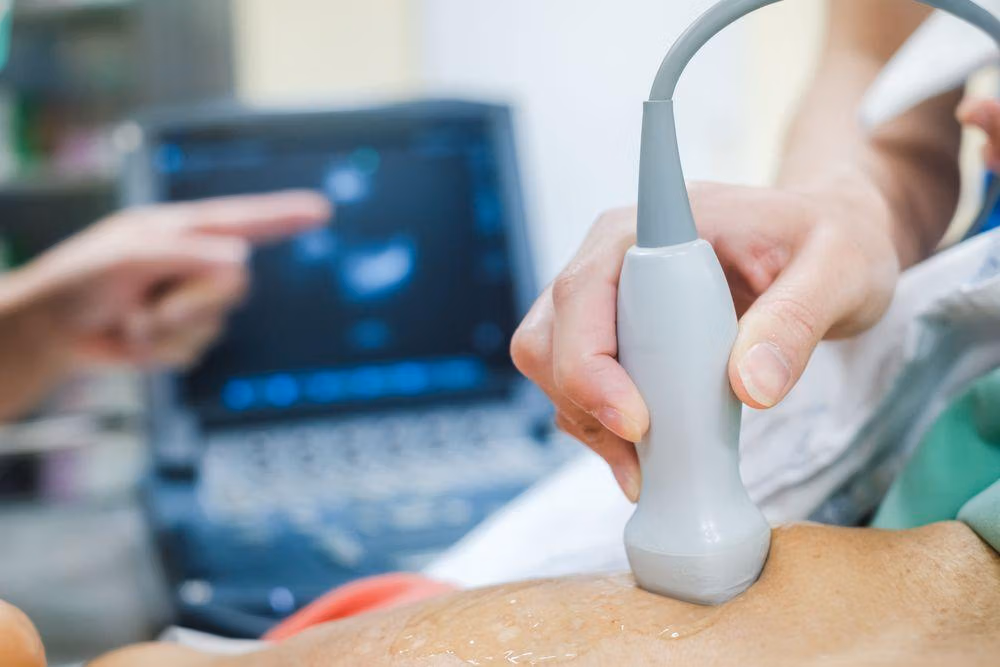Doctor,Is,Examining,Heart's,Patient,By,Echocardiogram,For,Diagnosis,Disease