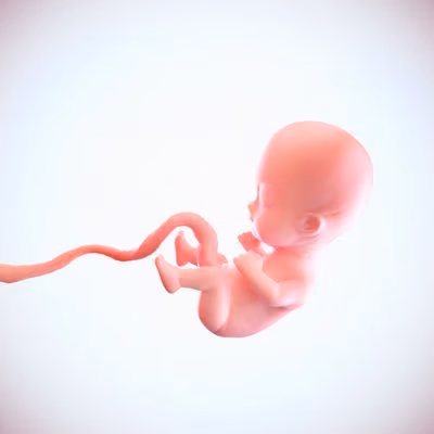 aborto aborto