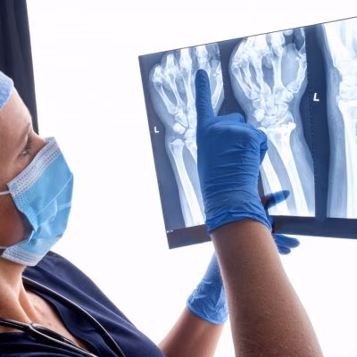 Orthopaedic,Surgeon,Studying,A,X-ray,Of,A,Broken,Radius,Bone Orthopaedic,Surgeon,Studying,A,X-ray,Of,A,Broken,Radius,Bone